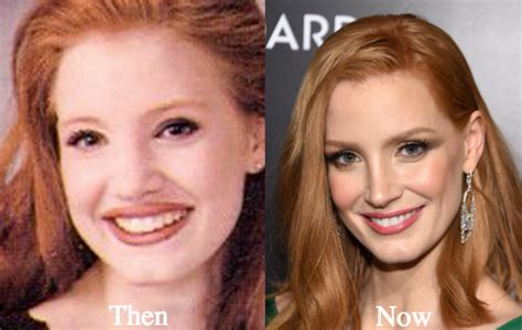 jessica chastain plastic surgery|Jessica Chastain Has Shut Down Plastic Surgery。